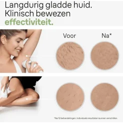 Heren Braun IPL Silk-expert Pro 3 PL3020