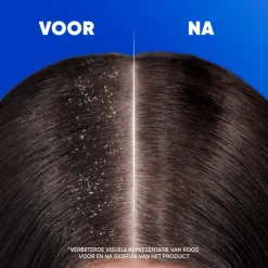Head and Shoulders Head & Shoulders Citrus Fresh Anti-roos Shampoo 625 ML