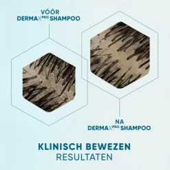 Head and Shoulders Head & Shoulders Derma X Pro Kalmeert Anti-Roos Shampoo 250 ML