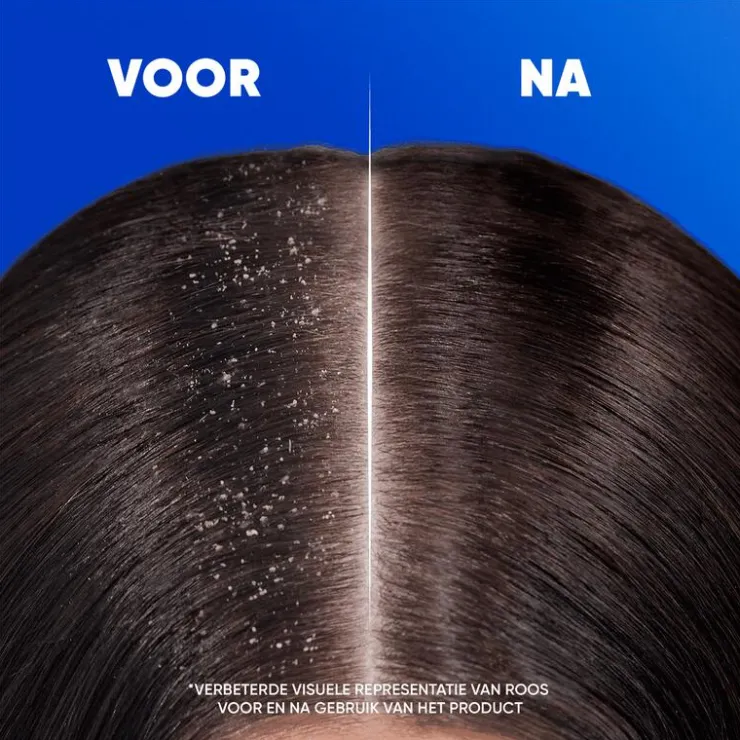 Head and Shoulders Head & Shoulders Menthol Fresh Anti-Roos Shampoo 300 ML