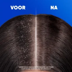 Head and Shoulders Head & Shoulders Menthol Fresh 2in1 Anti-Roos Shampoo & Conditioner 300 ML