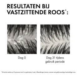 Vichy Dercos Anti-Roos DS Shampoo NH/VH Navulling 390 ML